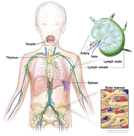 A diagram of a child’s lymph system with close-up images of a lymph node and bone marrow.