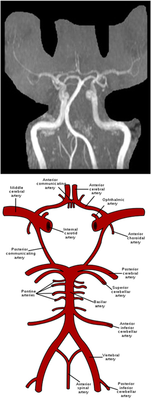 MRA Brain WO Protocol Image4