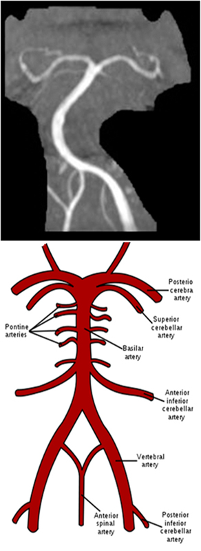 MRA Brain WO Protocol Image5