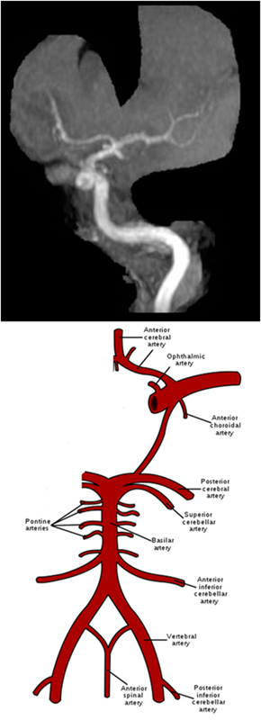 MRA Brain WO Protocol Image6