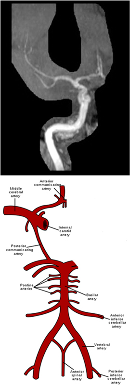 MRA Brain WO Protocol Image7