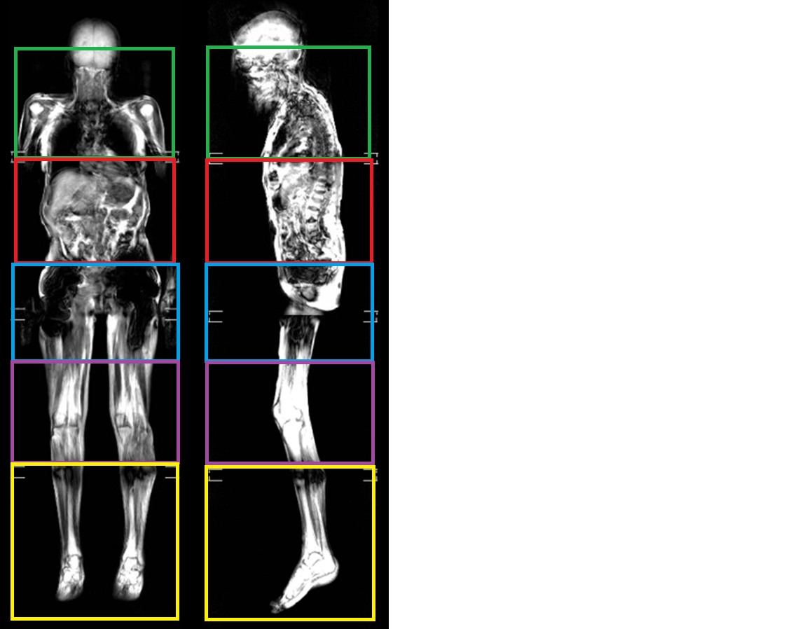 Full Body MRI Scan