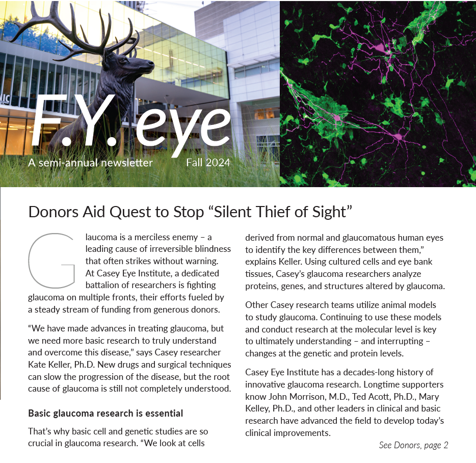 Two photos split the top with the title "FY Eye" overlaying a photo of an elk statue on the right and a photo of purple and green microscopic cells on the right. Below the images is text.