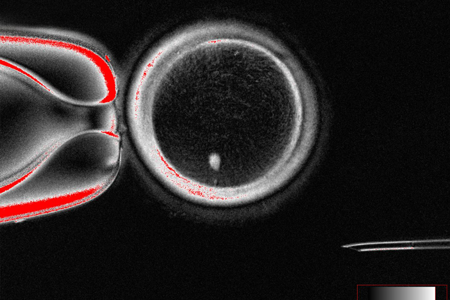 An oocyte with a bright image of a skin cell nucleus before fertilization.